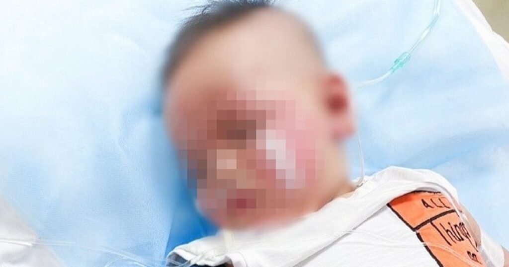 TPHCM: Bé trai 13 tháng tuổi nghẹt thở nguy kịch sau khi ăn bánh flan