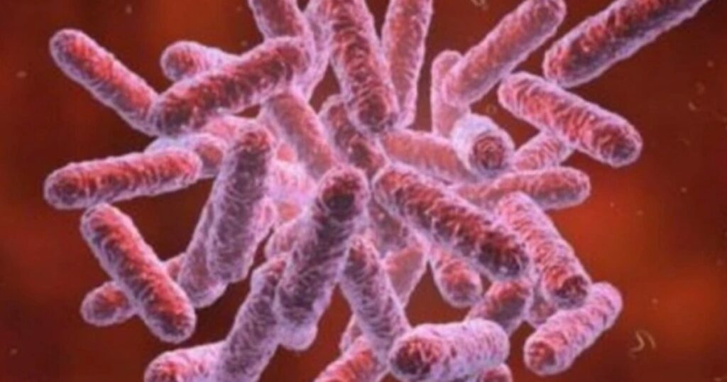 Cháu bé 4 tuổi bị nhiễm vi khuẩn "ăn thịt người"