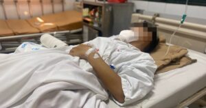 Nghịch pháo, nam sinh 15 tuổi bị cắt cụt tay phải